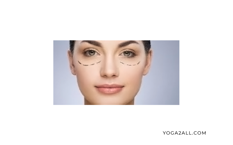 What Is puffy under eyes And How to Cure It?