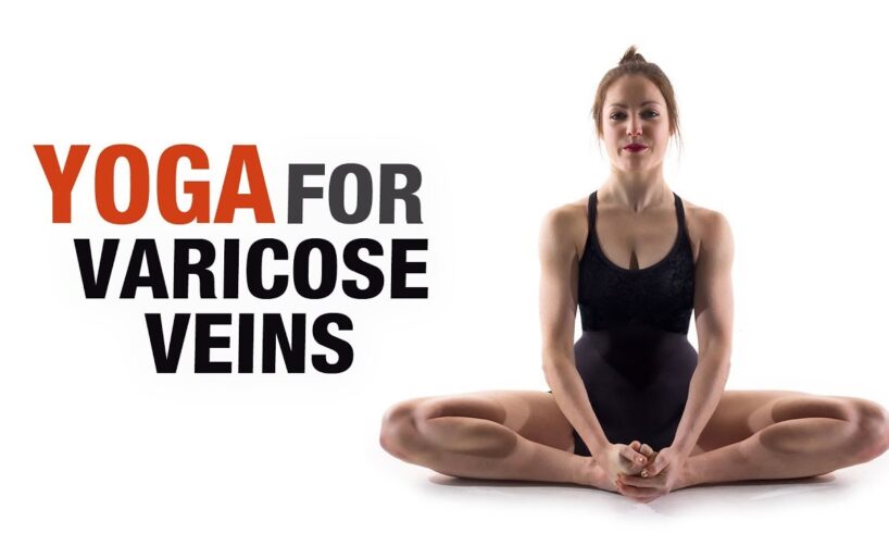 Varicose veins and yoga