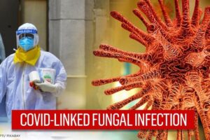 Back fungal infection in Covid Patients